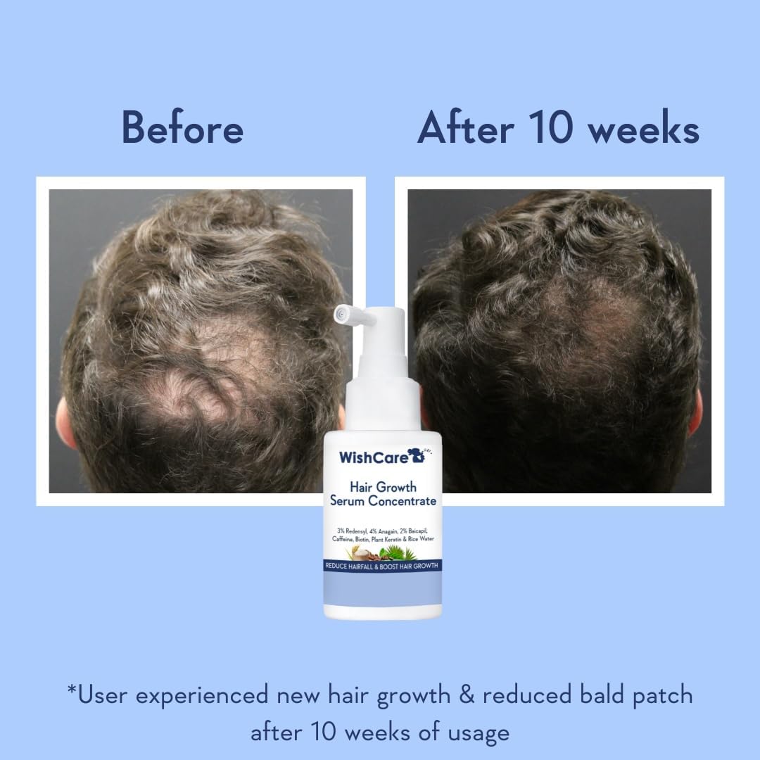 WishCare Hair Growth Serum Concentrate